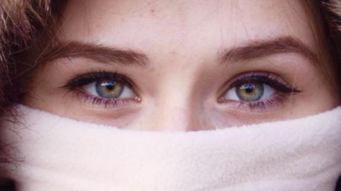 Central heterochromia eyes 😍