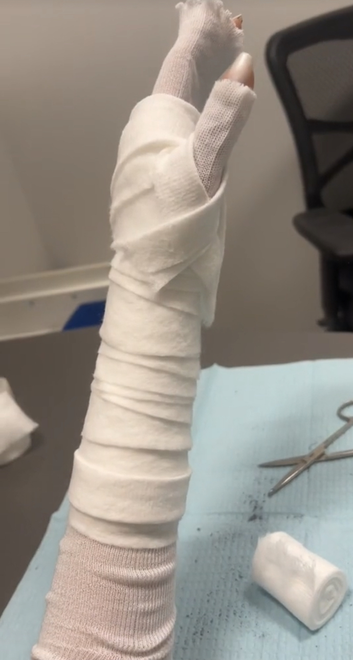 Have you ever broken/fractured something on your body? If so, where?