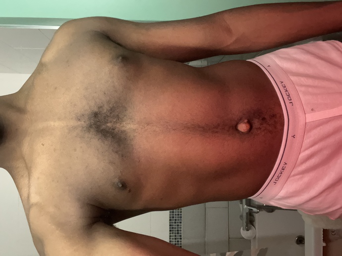 The right exercise for my body physique?