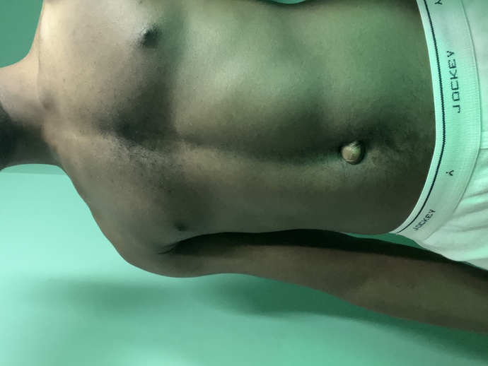 The right exercise for my body physique?