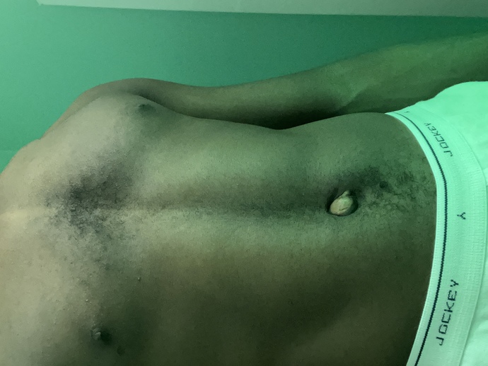 The right exercise for my body physique?