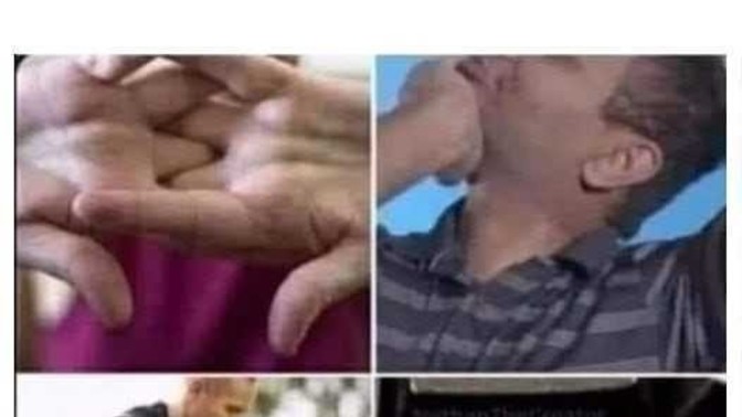 Do you still get those YYYYAAAAAAAA stretches?