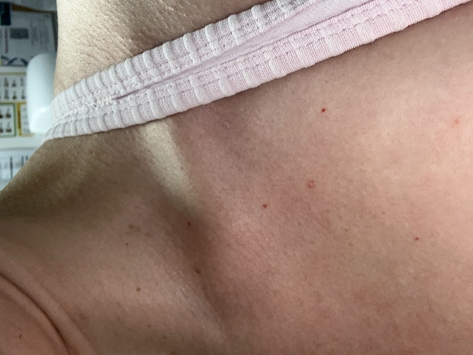 Does anyone know what these small red dots are?