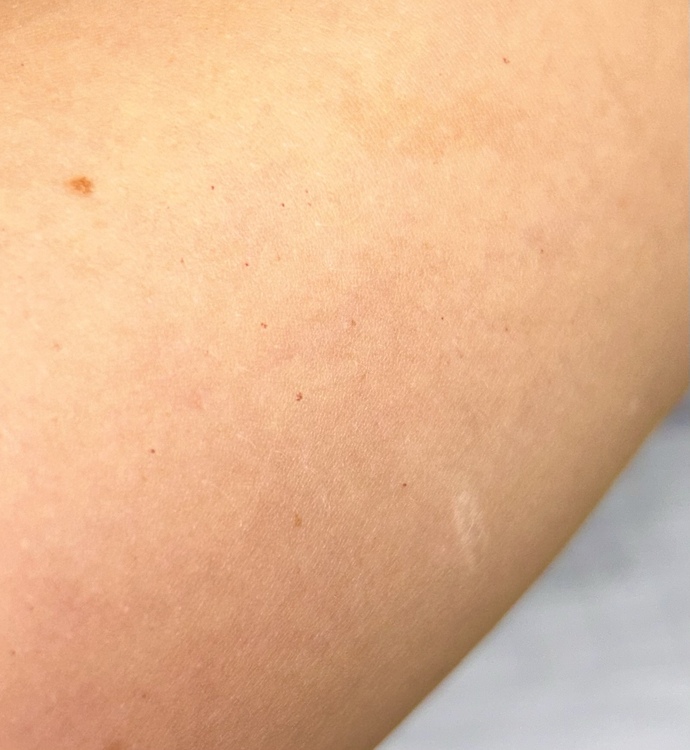 Does anyone know what these small red dots are?
