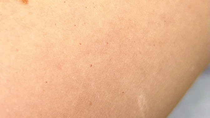 Does anyone know what these small red dots are?