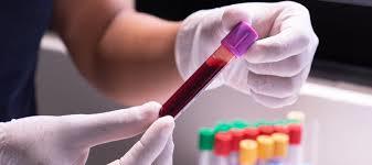 Has Anyone Experienced A Bad Experience in Receiving Blood Results from Their Doctor?