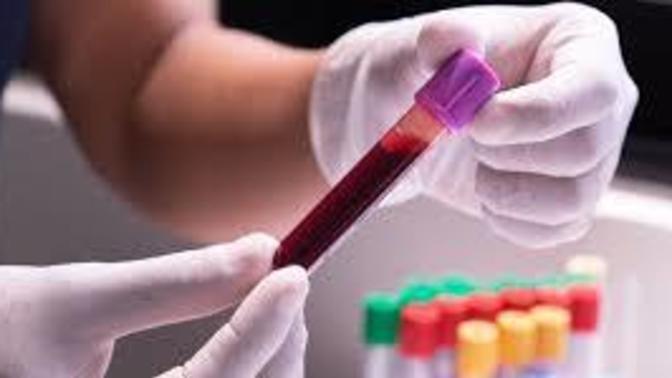 Has Anyone Experienced A Bad Experience in Receiving Blood Results from Their Doctor?