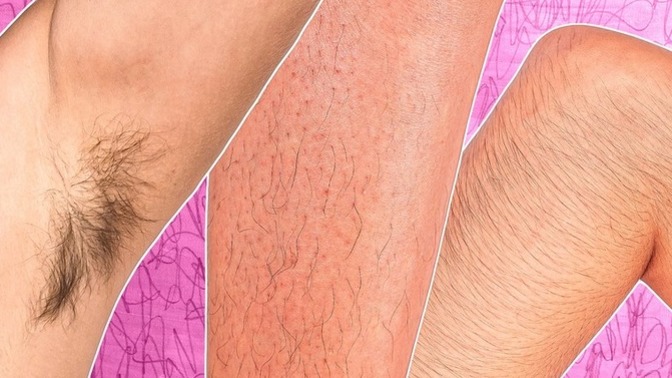 Are women with body hair more prevalent in today's society?