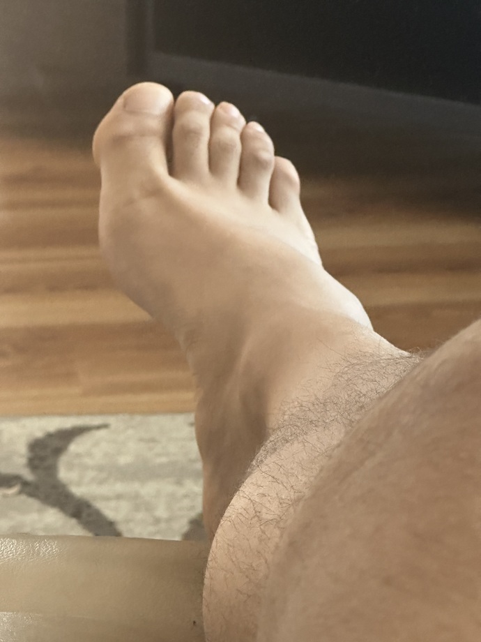 Here’s my badly hurt feet 😂