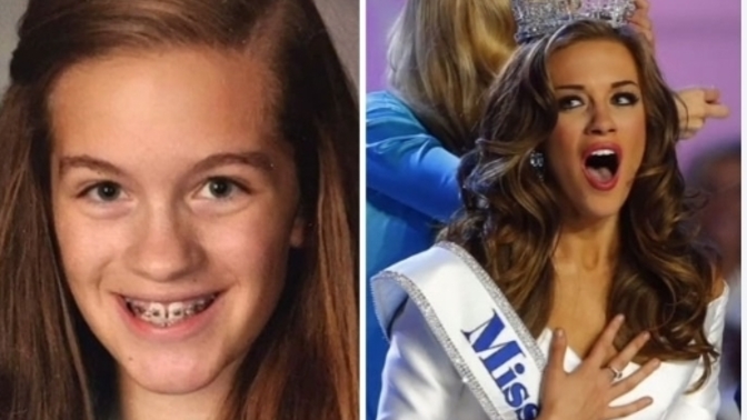 Did you have a puberty glow up or glow down😅?