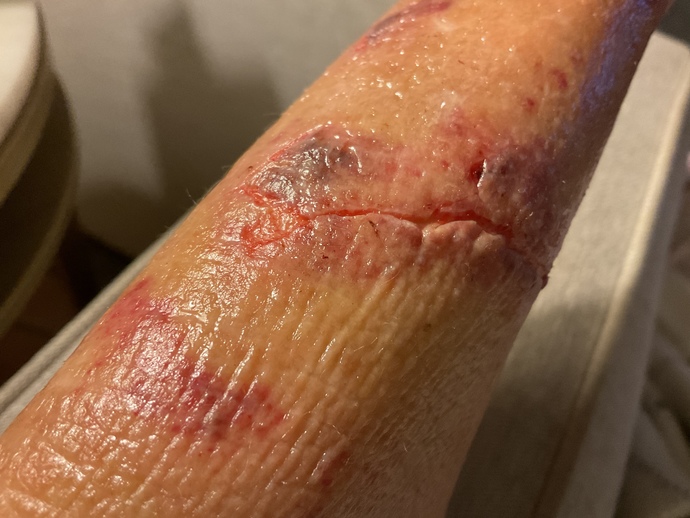 My dog did this an I wonder if I need stitches?
