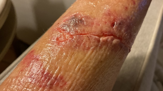 My dog did this an I wonder if I need stitches?
