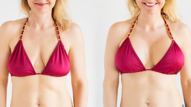 What are your thoughts on breast implants?