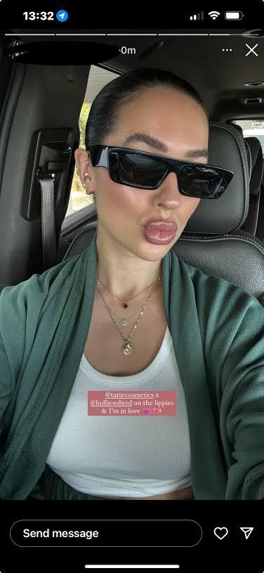 Exactly when did humanity started having hemorrhoids on their lips?