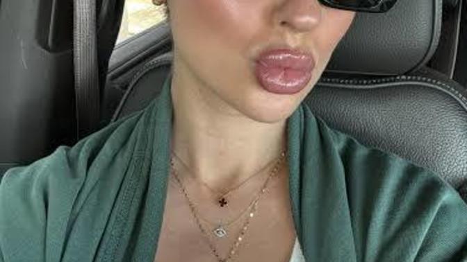 Exactly when did humanity started having hemorrhoids on their lips?
