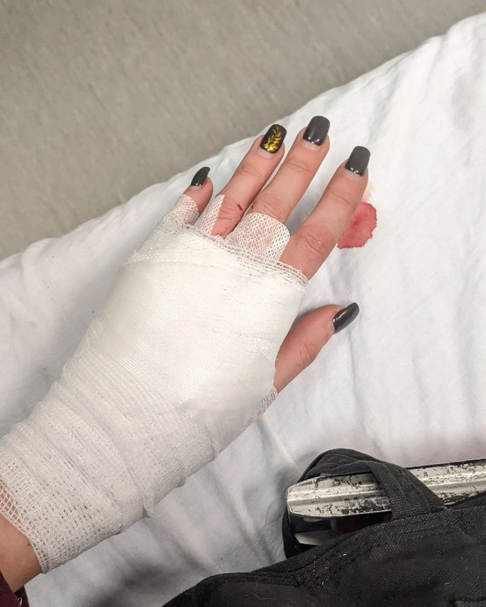 When was the last time you were in a hospital? And what was the reason?