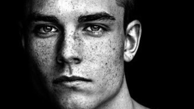 Girls, Girls - are freckles on guys' faces hot or not?