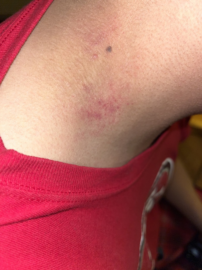 Does my boyfriend have a hickey? (Pic) ?
