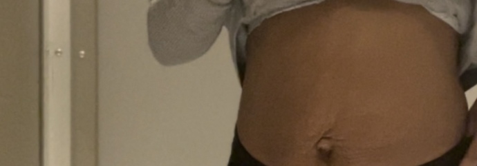 How much work in the gym would I have to put in to get rid of this c section/after baby tummy? And how unattractive does it look?