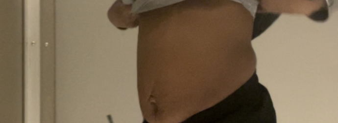 How much work in the gym would I have to put in to get rid of this c section/after baby tummy? And how unattractive does it look?