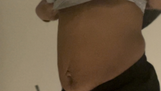 How much work in the gym would I have to put in to get rid of this c section/after baby tummy? And how unattractive does it look?