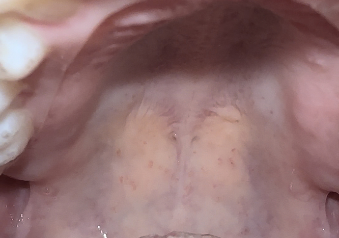What’s wrong with my mouth?