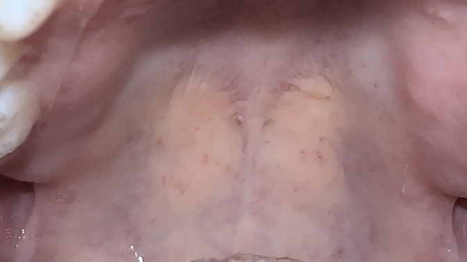 What’s wrong with my mouth?