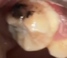 Does anyone know what kind of tooth this is?