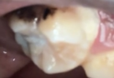 Does anyone know what kind of tooth this is?