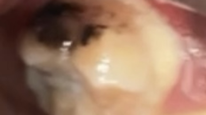 Does anyone know what kind of tooth this is?