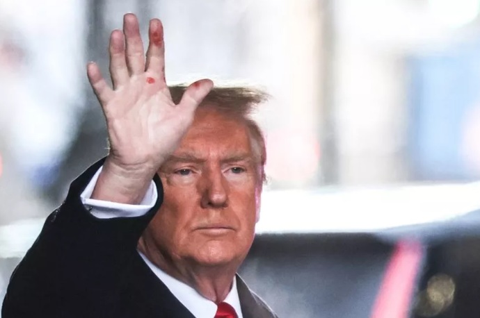 Orange face and a white syphilis hand?