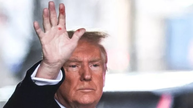 Does Donald Trump Have Syphilis?