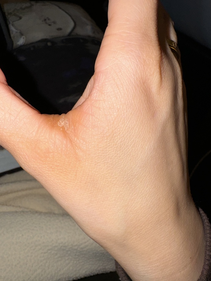 Have you ever seen anything like this before?