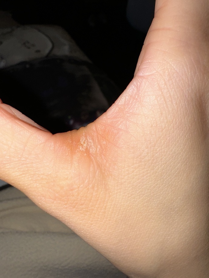 Have you ever seen anything like this before?