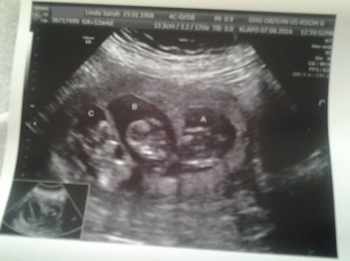 Girls, My girlfriend and me have a baby on the way and we are looking for some help with names any help would be appreciated?