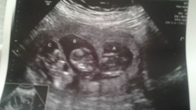 Girls, My girlfriend and me have a baby on the way and we are looking for some help with names any help would be appreciated?