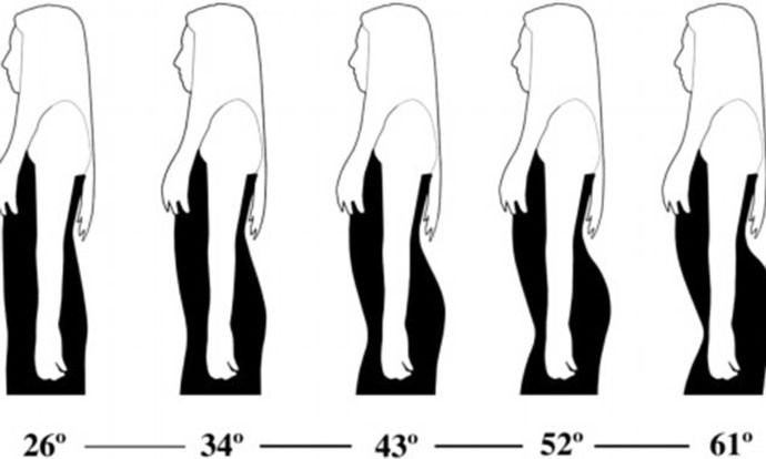 Lumbar Spine Curvature