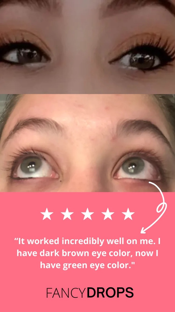 Would you use this eyedrops to change your eye colour?