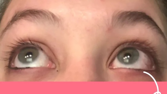 Would you use this eyedrops to change your eye colour?