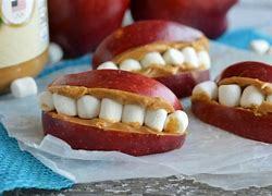 This should be the snack I eat once braces are off, don't you agree? LOL