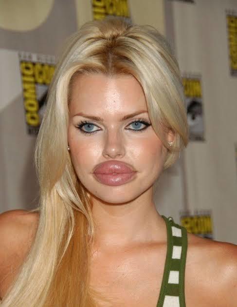 Have you had any cosmetic procedures done?