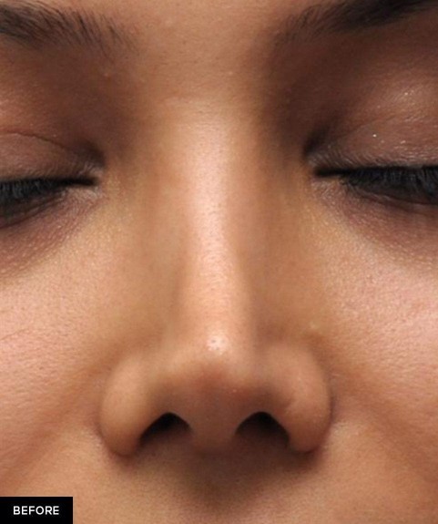 Guys, what do you think of girls whos had obvious plastic surgery?