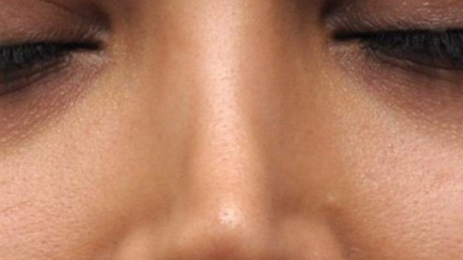 Guys, what do you think of girls who's had obvious plastic surgery?