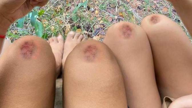 Have you any side effects when you go out for camping with your boyfriend?