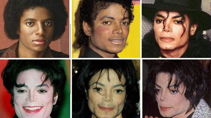 Would you date a woman if she had a nose job?