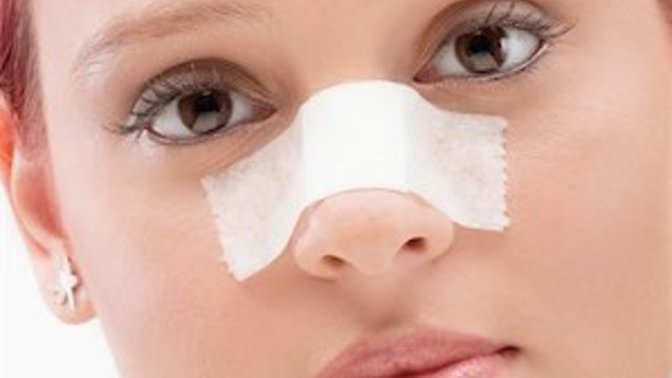 Would you date a woman if she had a nose job?