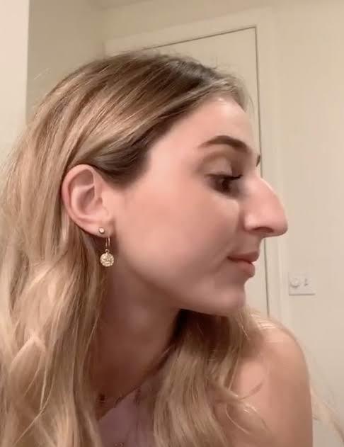 Can you love a women if she have hook nose?