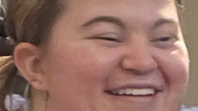 I feel like I look like I always have Down syndrome.. how to improve? my head is flat?