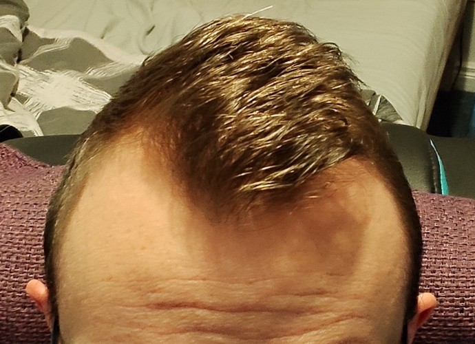Hair cut ideas for me please?