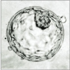 Did you know that the Alabama Supreme Court court ruled Friday that frozen embryos outside the womb are children?